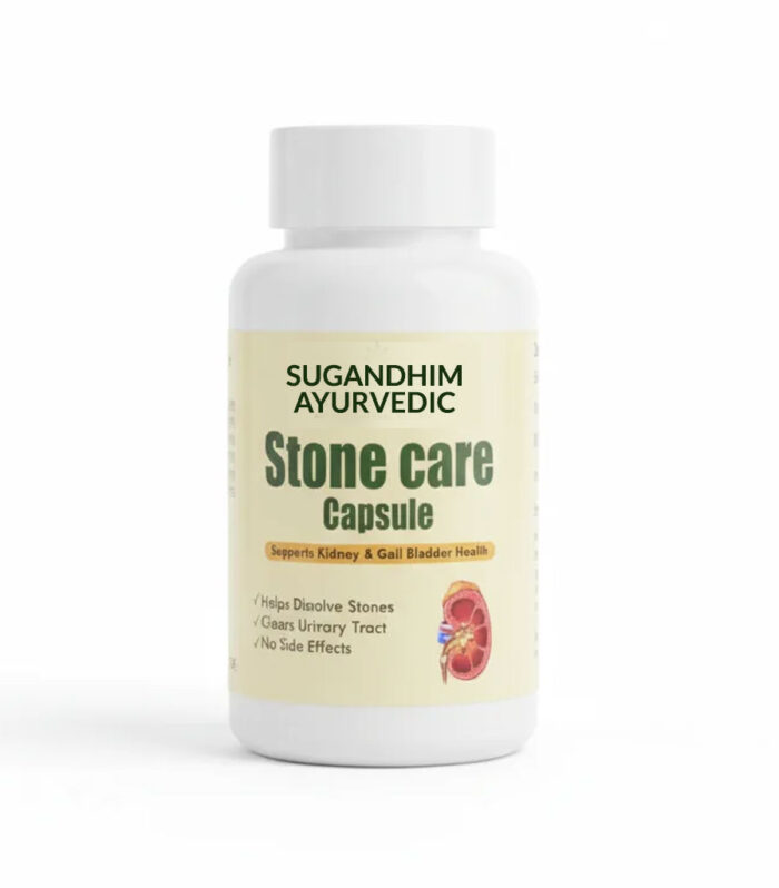 Ayurvedic Stone Care Capsules – 30 / 60 Capsules